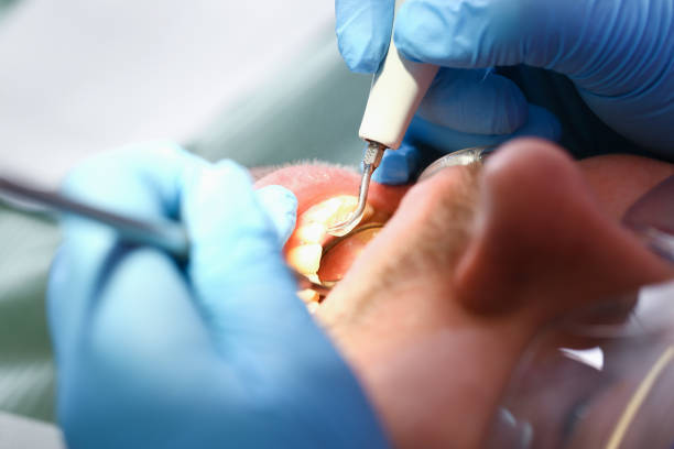 Best Emergency Dental Surgery in Wyboo, SC