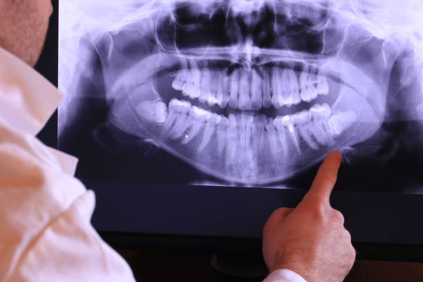 Best Emergency Tooth Extraction in Wyboo, SC
