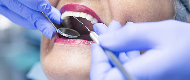 Best Emergency Root Canal Treatment in Wyboo, SC